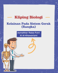 Image of Kliping: Kelainan Pada Sistem Gerak (Rangka)